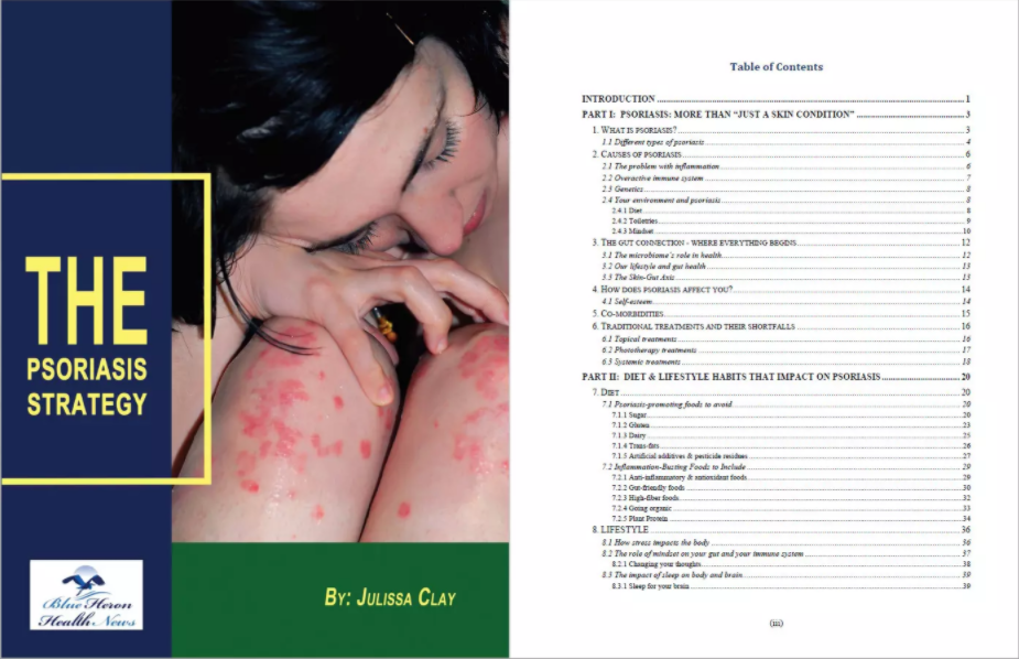 Psoriasis Strategy Table Of Contents