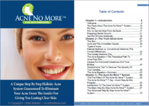 Acne No More Table Of Contents