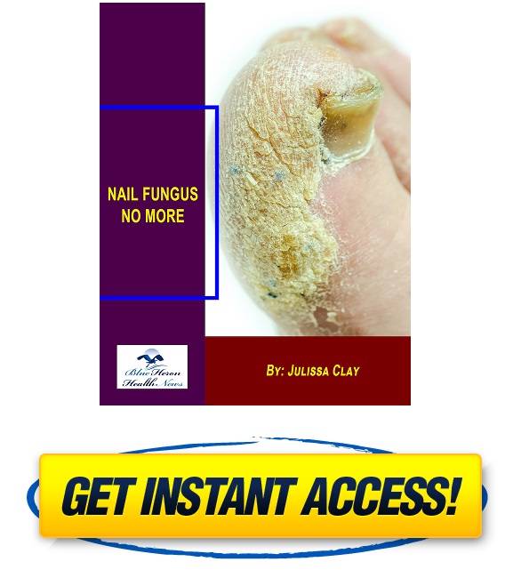 Download Nail Fungus No More Book